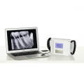 Hospital dedicated mobile high-frequency dental X-ray machine